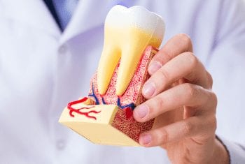 牙髓治疗