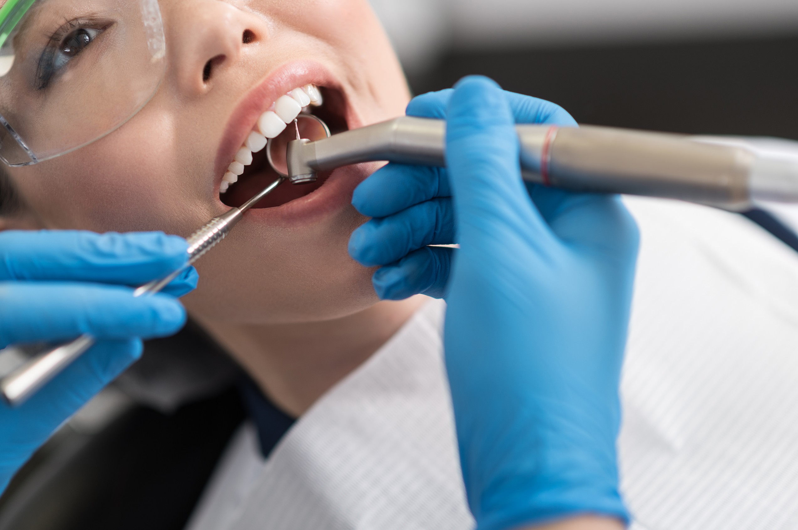What to Expect from a Dental Cleaning TAG Dental Clinic